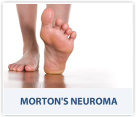 Morton's Neuroma - Dr Dan Bank